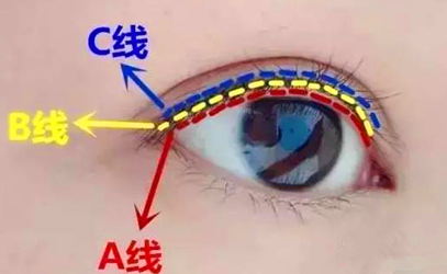 如何有效护理美瞳线 运用以下方法就可以了